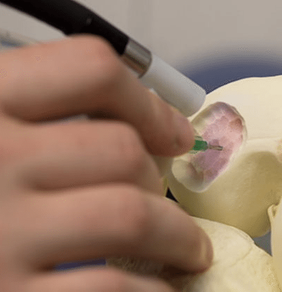 REGENERATIVE SURGICAL PEN DRAWS WITH STEM CELL INK