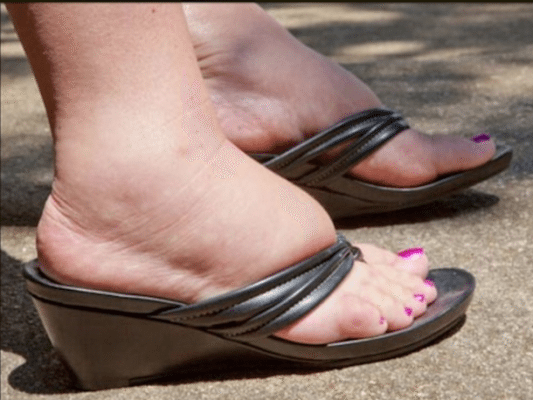 Natural Remedies for Swollen Ankles and Feet