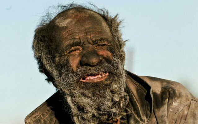 This Man Has Not Bathe or Showered in 60 Years – PIC