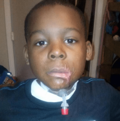 8-Year-Old African American, Shot By White Neighbor, Beginning To Recover