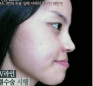 Oh god, Korean plastic surgery will never cease to amaze me