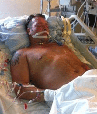 Paralysed Stroke Victim Helplessly Listened as Doctors Discussed Donating His Organs