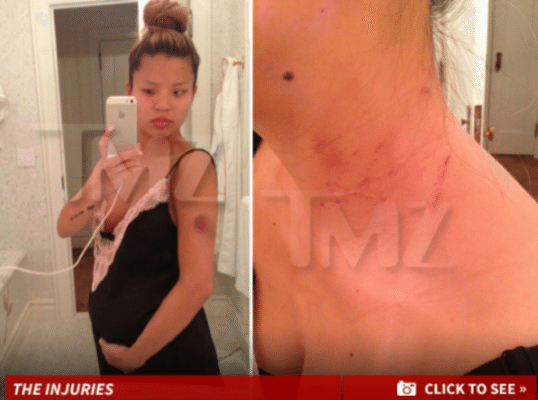 The Dream’s Domestic Violence Pictures Shown – PIC
