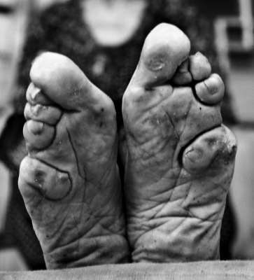 PICTURED: The last living Chinese women with bound feet