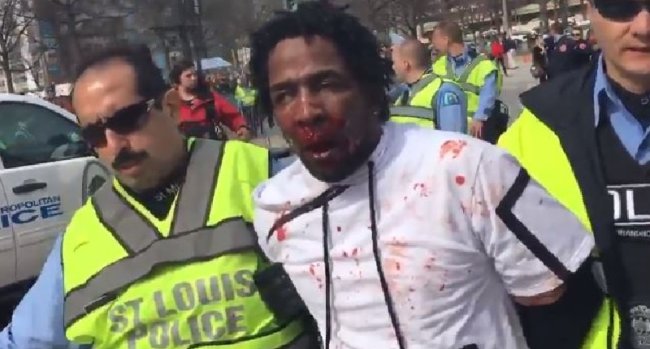 Black Protestor Covered in Blood at Trump Event – Vido